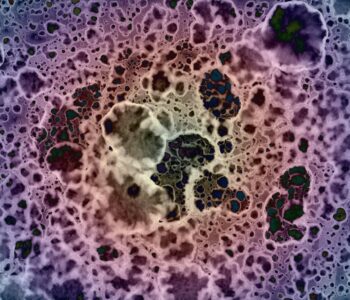 mononukleoza-zakazna-u-dzieci-objawy-diagnoza-i-skuteczne-leczenie