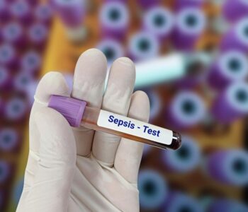 jak-odczytac-wynik-cytologii-uproszczona-interpretacja-wynikow-w-systemie-bethesda