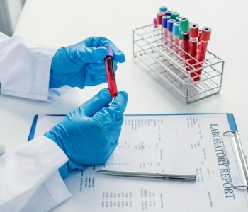 czy-gronkowiec-wyjdzie-w-morfologii-jakie-badania-go-wykrywaja