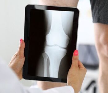 ile-kosztuje-rtg-kolana---od-czego-zalezy-cena