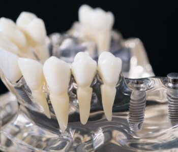 skutki-uboczne-implantow-z-tytanu---co-warto-wiedziec