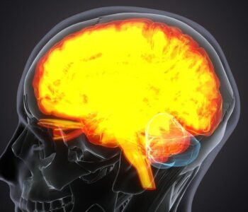 udar-prawej-polkuli-mozgu---skutki