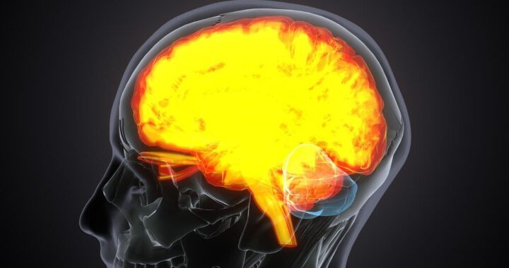 udar-prawej-polkuli-mozgu---skutki